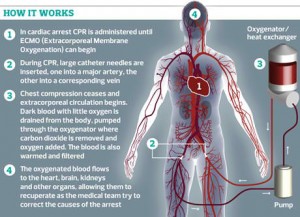 Graphic-by-Pete-Guest.-001